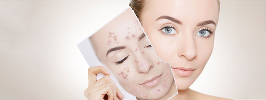 UNDERSTANDING THE DIFFERENCE BETWEEN SKIN TYPE AND SKIN CONCERN